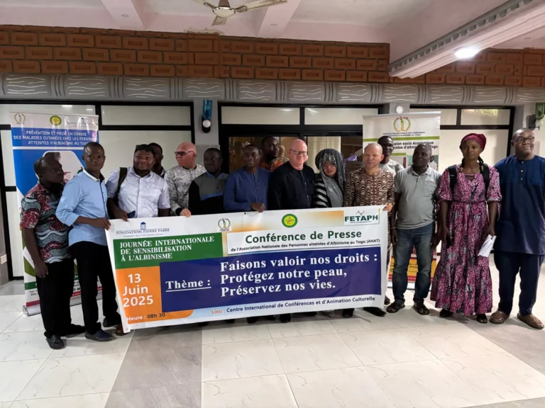 Albinisme au Togo : l’ANAT alerte sur l’urgence d’une prise en charge étatique des maladies cutanées