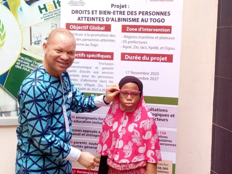 ANAT: des verres correcteurs remis à 20 enfants atteints d’albinisme à Lomé